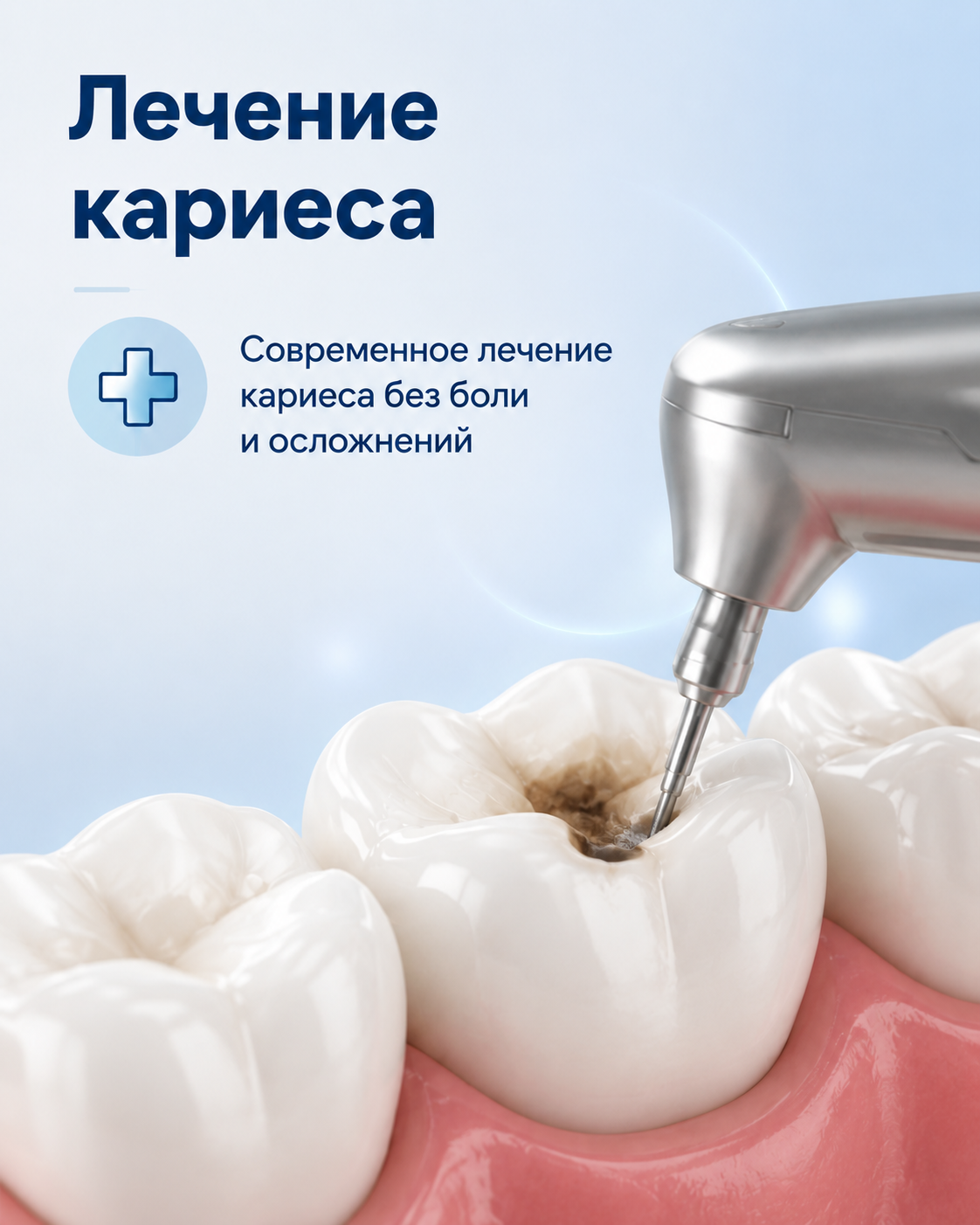 Лечение кариеса