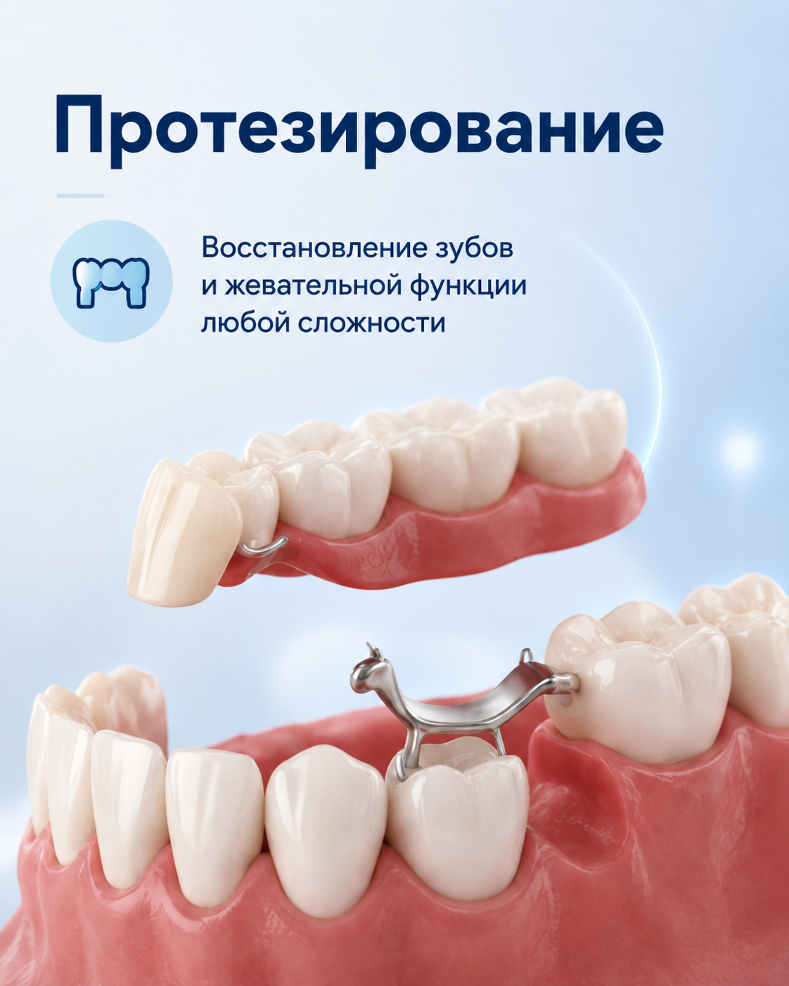 Протезирование